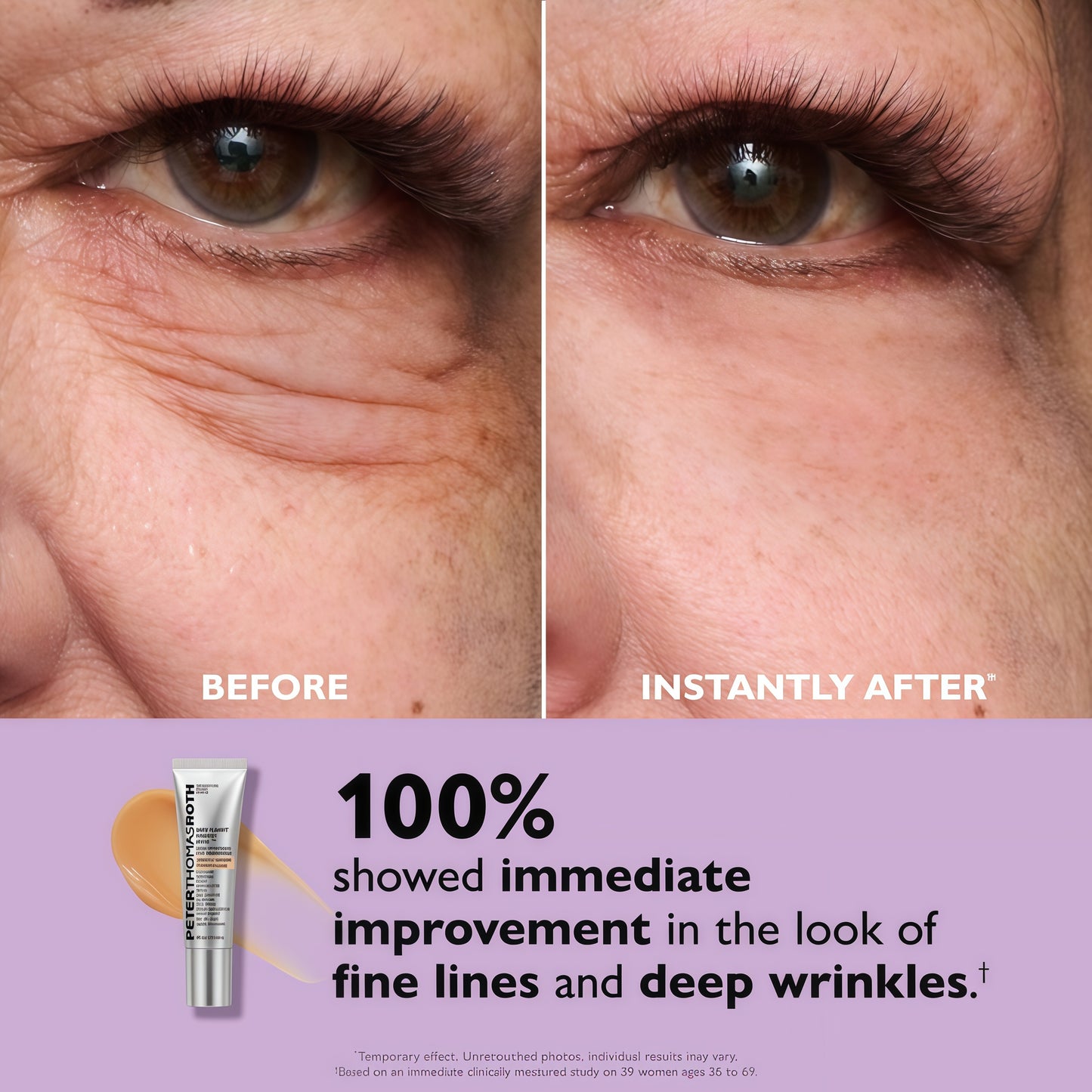 Peter Thomas Roth | Instant FIRMx EyeTemporary Eye Tightener