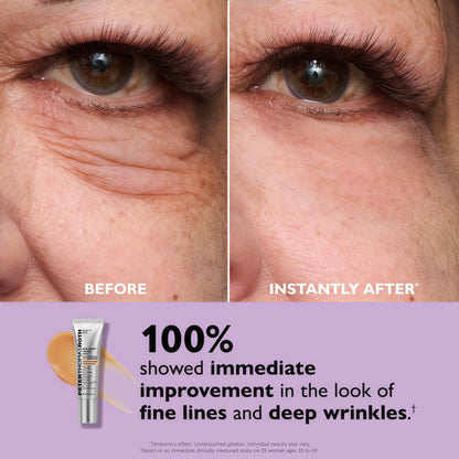 Peter Thomas Roth | Instant FIRMx EyeTemporary Eye Tightener