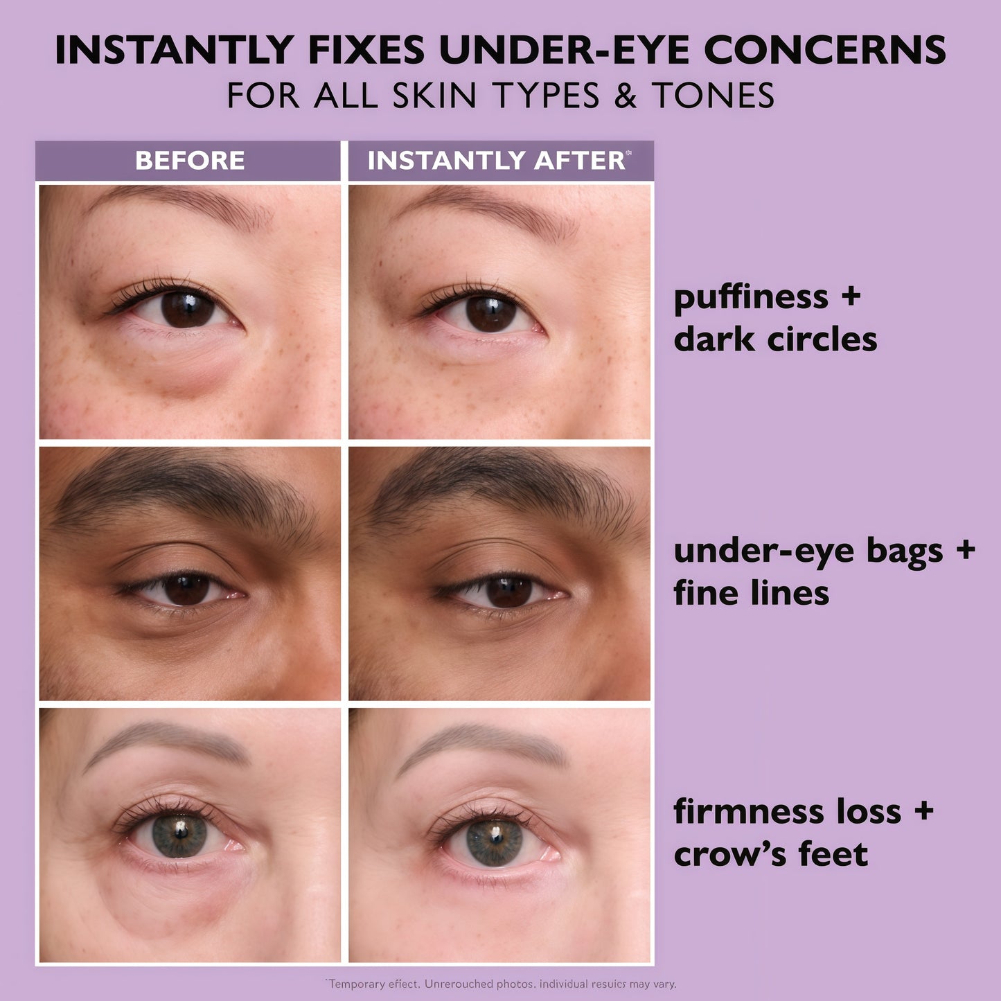 Peter Thomas Roth | Instant FIRMx EyeTemporary Eye Tightener